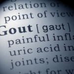 Title: About Gout:  Managing and Preventing Attacks
