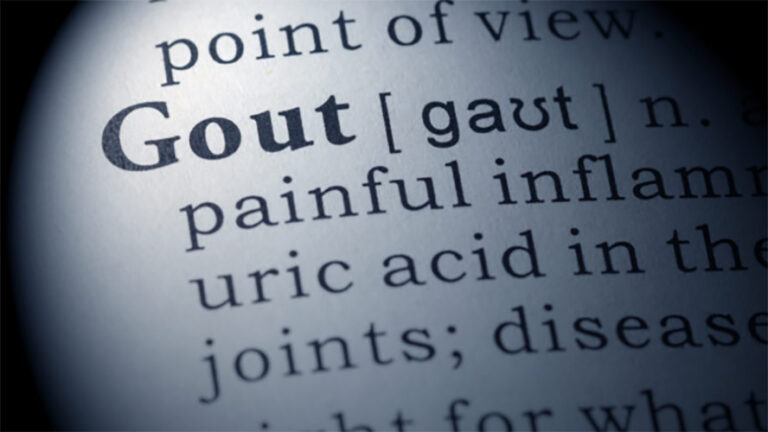 What is Gout? Symptoms, Treatment, and How to Prevent Gout Attacks