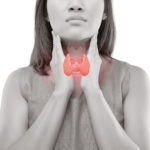 Title: A Q&A with Kelly Mandagere, MD:  Hypothyroidism