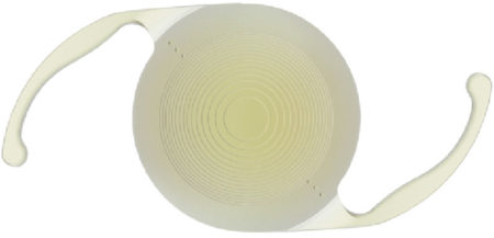 Cataract Surgery:  PanOptix® Trifocal Intraocular Lens