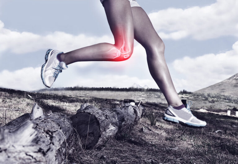 Treating Knee Arthritis