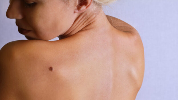 Boulder Dermatology: Quick Skin Checks Available