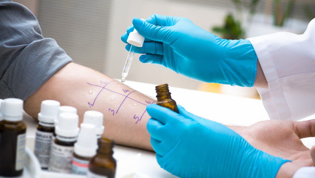 allergy testing