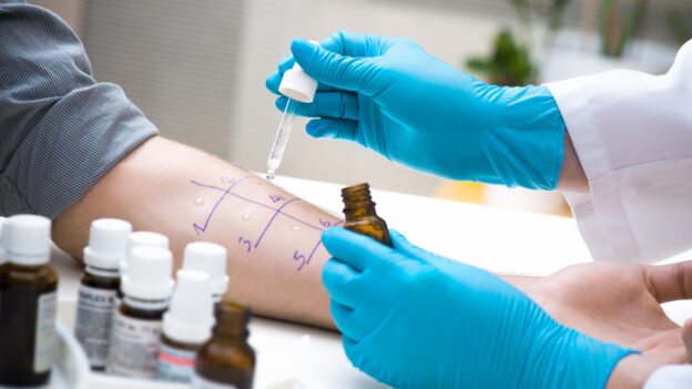 Why Stop Taking Antihistamines Before Allergy Testing