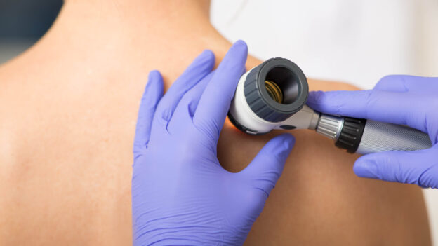 Do You Need a Skin Check? A Dermatologist’s Guide