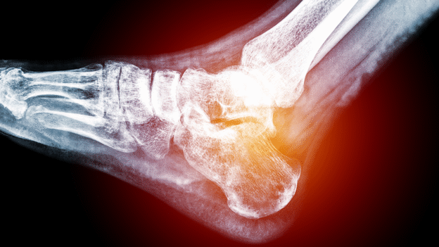 What is a Podiatrist? Understanding the Role of a DPM
