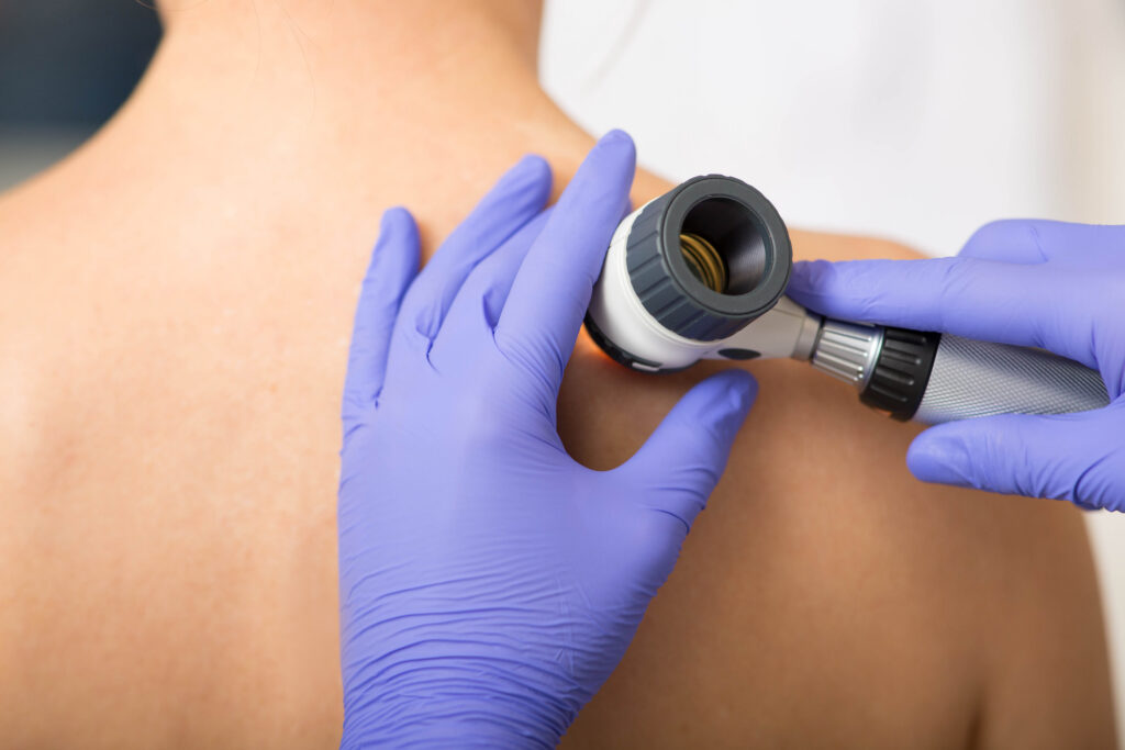 same day dermatology skin check boulder medical center