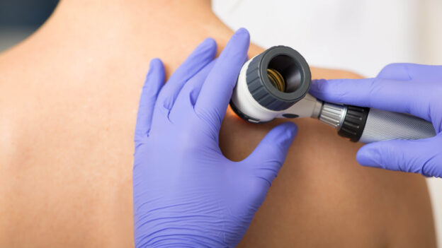 Same-Day Dermatology Appointments in Boulder: Rashes and Spots of Concern