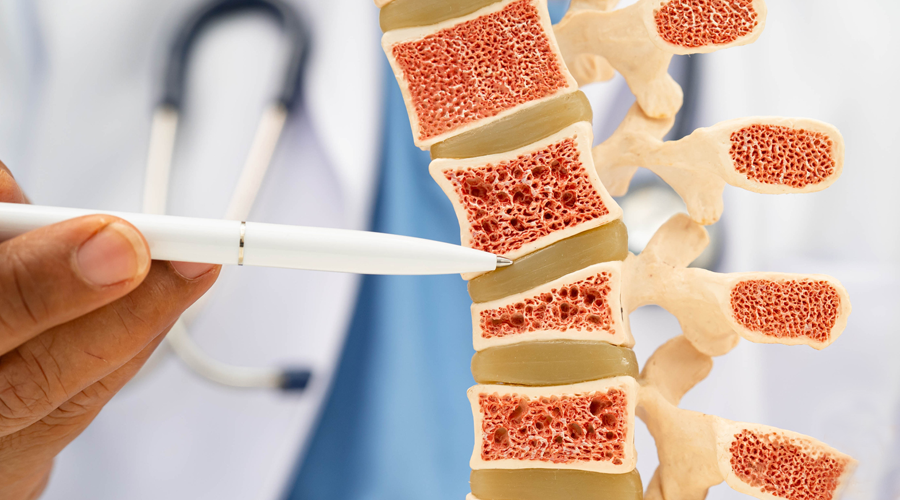 Osteoporosis - Rheumatologist - Boulder Medical Center